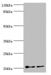 Western blot All lanes: UBE2C antibody at 2µg/ml Lane 1: Hela whole cell lysate Lane 2: U87 whole cell lysate Secondary Goat polyclonal to rabbit IgG at 1/10000 dilution Predicted band size: 20, 16, 17, 18 kDa Observed band size: 20 kDa