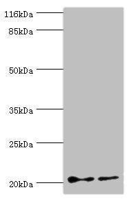 Western blot All lanes: UBE2C antibody at 2µg/ml Lane 1: Hela whole cell lysate Lane 2: U87 whole cell lysate Secondary Goat polyclonal to rabbit IgG at 1/10000 dilution Predicted band size: 20, 16, 17, 18 kDa Observed band size: 20 kDa