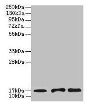 Western blot All lanes: UBE2D1 antibody at 2µg/ml Lane 1: Mouse thymus tissue Lane 2: NIH/3T3 whole cell lysate Lane 3: Jurkat whole cell lysate Secondary Goat polyclonal to rabbit IgG at 1/10000 dilution Predicted band size: 17 kDa Observed band...