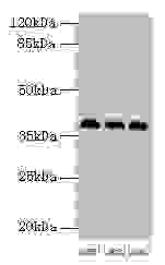 Western blot All lanes: HNRNPD antibody at 2µg/ml Lane 1: 293T whole cell lysate Lane 2: Hela whole cell lysate Lane 3: Jurkat whole cell lysate Secondary Goat polyclonal to rabbit IgG at 1/10000 dilution Predicted band size: 39, 37, 33, 31 kDa Ob...