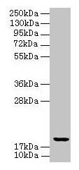 Western blot All lanes: UBE2G2 antibody at 8µg/ml + K562 whole cell lysate Secondary Goat polyclonal to rabbit IgG at 1/10000 dilution Predicted band size: 19, 16 kDa Observed band size: 19 kDa