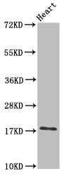 Western Blot Positive WB detected in: Mouse heart tissue All lanes: UBE2L3 antibody at 3ug/ml Secondary Goat polyclonal to rabbit IgG at 1/50000 dilution Predicted band size: 18, 15, 25 kDa Observed band size: 18 kDa
