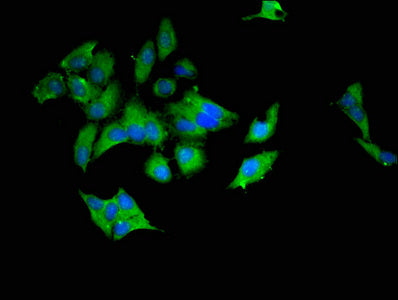 Immunofluorescent analysis of Hela cells using CSB-PA025466LA01HU at dilution of 1:100 and Alexa Fluor 488-congugated AffiniPure Goat Anti-Rabbit IgG(H+L)