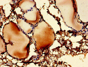 Immunohistochemistry of paraffin-embedded human thyroid tissue using CSB-PA025482LA01HU at dilution of 1:100