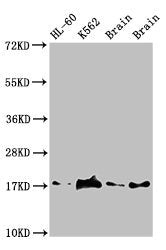 Western Blot Positive WB detected in: HL60 whole cell lysate, K562 whole cell lyaste, Mouse brain tissue, Rat brain tissue All lanes: UBE2V2 antibody at 1.5µg/ml Secondary Goat polyclonal to rabbit IgG at 1/50000 dilution Predicted band size: 17 k...