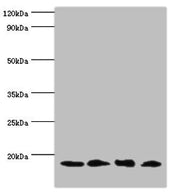 Western blot All lanes: UBE2V2 antibody at 3µg/ml Lane 1: Hela whole cell lysate Lane 2: Mouse brain tissue Lane 3: Jurkat whole cell lysate Lane 4: K562 whole cell lysate Secondary Goat polyclonal to rabbit IgG at 1/10000 dilution Predicted band...