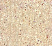 Immunohistochemistry of paraffin-embedded human brain tissue using CSB-PA025484HA01HU at dilution of 1:100