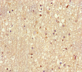 Immunohistochemistry of paraffin-embedded human brain tissue using CSB-PA025484HA01HU at dilution of 1:100