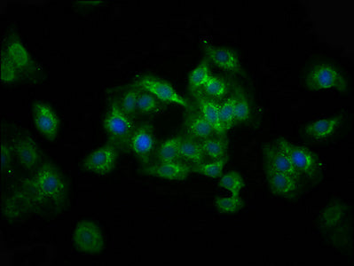 Immunofluorescence staining of HepG2 cells with CSB-PA025534LA01HU at 1:100, counter-stained with DAPI. The cells were fixed in 4% formaldehyde, permeabilized using 0.2% Triton X-100 and blocked in 10% normal Goat Serum. The cells were then incuba...