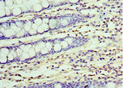 Immunohistochemistry of paraffin-embedded human colon tissue using CSB-PA025543DSR2HU at dilution of 1:100