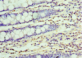 Immunohistochemistry of paraffin-embedded human colon tissue using CSB-PA025543DSR2HU at dilution of 1:100