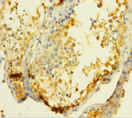 Immunohistochemistry of paraffin-embedded human testis tissue using CSB-PA025546LA01HU at dilution of 1:100