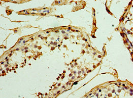 Immunohistochemistry of paraffin-embedded human testis tissue using CSB-PA025554ESR1HU at dilution of 1:100