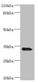 Western blot All lanes: Mitochondrial brown fat uncoupling protein 1 antibody at 2ug/ml + Mouse kidney tissue Secondary Goat polyclonal to rabbit IgG at 1/10000 dilution Predicted band size: 33 kDa Observed band size: 33 kDa
