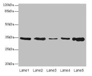 Western blot All lanes: UCP3 antibody at 0.9µg/ml Lane 1: Jurkat whole cell lysate Lane 2: SH-SY5Y whole cell lysate Lane 3: U251 whole cell lysate Lane 4: A549 whole cell lysate Lane 5: Hela whole cell lysate Secondary Goat polyclonal to rabbit I...