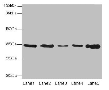 Western blot All lanes: UCP3 antibody at 0.9µg/ml Lane 1: Jurkat whole cell lysate Lane 2: SH-SY5Y whole cell lysate Lane 3: U251 whole cell lysate Lane 4: A549 whole cell lysate Lane 5: Hela whole cell lysate Secondary Goat polyclonal to rabbit I...