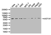 Western Blot Positive WB detected in: Hela whole cell lysate(20µg), PC-3 whole cell lysate(20µg), K562 whole cell lysate(20µg), MCF-7 whole cell lysate(20µg), 293 whole cell lysate(20µg), A549 whole cell lysate(20µg), HepG2 whole cell lysate(20µg)...