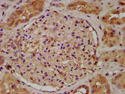IHC image of CSB-PA025579LA01HU diluted at 1:200 and staining in paraffin-embedded human kidney tissue performed on a Leica BondTM system. After dewaxing and hydration, antigen retrieval was mediated by high pressure in a citrate buffer (pH 6.0)....