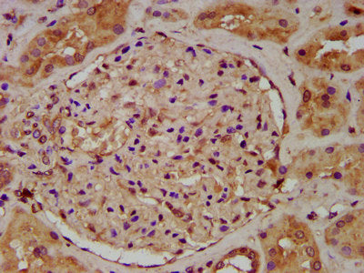IHC image of CSB-PA025579LA01HU diluted at 1:200 and staining in paraffin-embedded human kidney tissue performed on a Leica BondTM system. After dewaxing and hydration, antigen retrieval was mediated by high pressure in a citrate buffer (pH 6.0)....