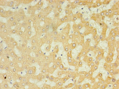 Immunohistochemistry of paraffin-embedded human liver tissue using CSB-PA025597LA01HU at dilution of 1:100