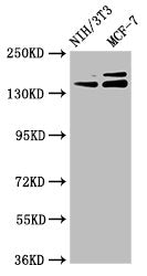 Western Blot Positive WB detected in: NIH/3T3 whole cell lysate, MCF-7 whole cell lysate All lanes: UMODL1 antibody at 5.1µg/ml Secondary Goat polyclonal to rabbit IgG at 1/50000 dilution Predicted band size: 145, 157, 137, 150 kDa Observed band s...