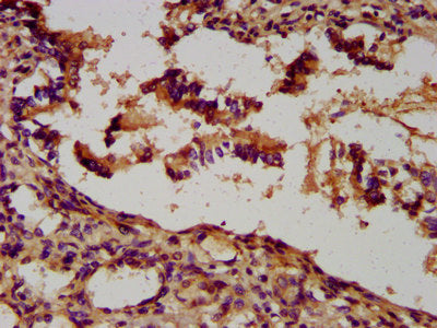 IHC image of CSB-PA025629LA01HU diluted at 1:300 and staining in paraffin-embedded human lung tissue performed on a Leica BondTM system. After dewaxing and hydration, antigen retrieval was mediated by high pressure in a citrate buffer (pH 6.0). Se...