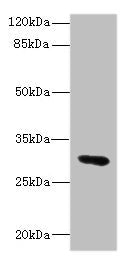 Western blot All lanes: UPK3A antibody IgG at 1.76ug/ml + Mouse lung tissue Secondary Goat polyclonal to rabbit IgG at 1/10000 dilution Predicted band size: 31, 18 kDa Observed band size: 31 kDa