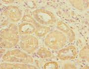 Immunohistochemistry of paraffin-embedded human kidney tissue using CSB-PA025657ESR2HU at dilution of 1:100
