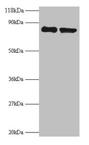 Western blot All lanes: RPS10 antibody at 2µg/ml Lane 1: EC109 whole cell lysate Lane 2: 293T whole cell lysate Secondary Goat polyclonal to rabbit IgG at 1/15000 dilution Predicted band size: 19 kDa Observed band size: 80 kDa
