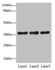 Western blot All lanes: UPP2 antibody at 4µg/ml Lane 1: Mouse kidney tissue Lane 2: Mouse brain tissue Lane 3: Hela whole cell lysate Secondary Goat polyclonal to rabbit IgG at 1/10000 dilution Predicted band size: 36, 42 kDa Observed band size: 3...