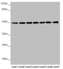 Western blot All lanes: UQCRC1 antibody at 2.5µg/ml Lane 1: Mouse large intestine tissue Lane 2: Mouse kidney tissue Lane 3: Mouse brain tissue Lane 4: LO2 whole cell lysate Lane 5: Hela whole cell lysate Lane 6: HepG2 whole cell lysate Lane 7: MC...