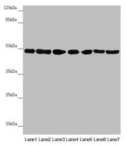 Western blot All lanes: UQCRC2 antibody at 2.95µg/ml Lane 1: Human placenta tissue Lane 2: Mouse large intestine tissue Lane 3: Mouse small intestine tissue Lane 4: Mouse brain tissue Lane 5: HepG2 whole cell lysate Lane 6: Jurkat whole cell lysat...
