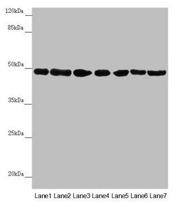 Western blot All lanes: UQCRC2 antibody at 2.95µg/ml Lane 1: Human placenta tissue Lane 2: Mouse large intestine tissue Lane 3: Mouse small intestine tissue Lane 4: Mouse brain tissue Lane 5: HepG2 whole cell lysate Lane 6: Jurkat whole cell lysat...