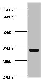 Western blot All lanes: USF1 antibody at 2µg/ml + HepG2 whole cell lysate Secondary Goat polyclonal to rabbit IgG at 1/10000 dilution Predicted band size: 34, 28 kDa Observed band size: 34 kDa