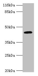 Western blot All lanes: USP12 antibody at 2µg/ml + Mouse liver tissue Secondary Goat polyclonal to rabbit IgG at 1/10000 dilution Predicted band size: 43 kDa Observed band size: 43 kDa