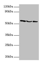 Western blot All lanes: USP14 antibody at 2µg/ml Lane 1: Hela whole cell lysate Lane 2: 293T whole cell lysate Lane 3: NIH/3T3 whole cell lysate Secondary Goat polyclonal to rabbit IgG at 1/10000 dilution Predicted band size: 57, 53, 55 kDa Observ...