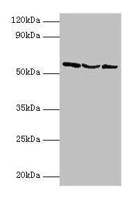 Western blot All lanes: USP14 antibody at 2µg/ml Lane 1: Hela whole cell lysate Lane 2: 293T whole cell lysate Lane 3: NIH/3T3 whole cell lysate Secondary Goat polyclonal to rabbit IgG at 1/10000 dilution Predicted band size: 57, 53, 55 kDa Observ...