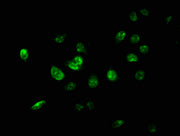 Immunofluorescence staining of A549 cells with CSB-PA025738LA01HU at 1:267, counter-stained with DAPI. The cells were fixed in 4% formaldehyde, permeabilized using 0.2% Triton X-100 and blocked in 10% normal Goat Serum. The cells were then incubat...