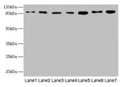 Western blot All lanes: USP5 antibody at 10µg/ml Lane 1: Mouse brain tissue Lane 2: A549 whole cell lysate Lane 3: MCF-7 whole cell lysate Lane 4: A375 whole cell lysate Lane 5: U251 whole cell lysate Secondary Goat polyclonal to rabbit IgG at 1/1...
