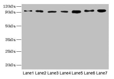 Western blot All lanes: USP5 antibody at 10µg/ml Lane 1: Mouse brain tissue Lane 2: A549 whole cell lysate Lane 3: MCF-7 whole cell lysate Lane 4: A375 whole cell lysate Lane 5: U251 whole cell lysate Secondary Goat polyclonal to rabbit IgG at 1/1...