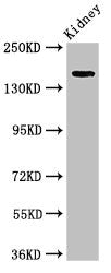 Western Blot Positive WB detected in: Rat kidney tissue All lanes: USP6 antibody at 4ug/ml Secondary Goat polyclonal to rabbit IgG at 1/50000 dilution Predicted band size: 159, 122, 90 kDa Observed band size: 159 kDa