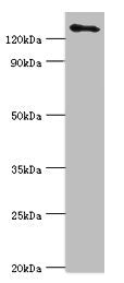 Western blot All lanes: USP8 antibody at 14ug/ml + 293T whole cell lysate Secondary Goat polyclonal to rabbit IgG at 1/10000 dilution Predicted band size: 128, 116 kDa Observed band size: 128 kDa