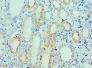 Immunohistochemistry of paraffin-embedded human kidney tissue using CSB-PA025771ESR1HU at dilution of 1:100