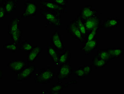 Immunofluorescence staining of Hela cells with CSB-PA025775LA01HU at 1:133, counter-stained with DAPI. The cells were fixed in 4% formaldehyde, permeabilized using 0.2% Triton X-100 and blocked in 10% normal Goat Serum. The cells were then incubat...