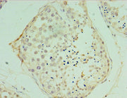 Immunohistochemistry of paraffin-embedded human testis tissue using CSB-PA025781ESR2HU at dilution of 1:100