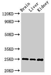 Western Blot Positive WB detected in: Mouse brain tissue, Mouse liver tissue, Mouse kidney tissue All lanes: VAMP7 antibody at 2µg/ml Secondary Goat polyclonal to rabbit IgG at 1/50000 dilution Predicted band size: 25, 31, 21 kDa Observed band siz...