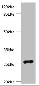 Western blot All lanes: Vesicle-associated membrane protein-associated protein B/C antibody at 3ug/ml + Mouse brain tissue Secondary Goat polyclonal to rabbit IgG at 1/10000 dilution Predicted band size: 28, 12 kDa Observed band size: 28 kDa