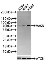 Western Blot Positive WB detected in: SY5Y whole cell lysate(30µg), K562 whole cell lysate(30µg), HL60 whole cell lysate(30µg) All lanes: VASN antibody at 1:1000 Secondary Goat polyclonal to rabbit IgG at 1/20000 dilution Predicted band size: 72 k...