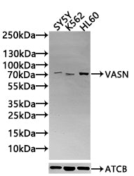 Western Blot Positive WB detected in: SY5Y whole cell lysate(30µg), K562 whole cell lysate(30µg), HL60 whole cell lysate(30µg) All lanes: VASN antibody at 1:1000 Secondary Goat polyclonal to rabbit IgG at 1/20000 dilution Predicted band size: 72 k...