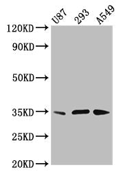 Western Blot Positive WB detected in: U87 whole cell lysate, 293 whole cell lysate, A549 whole cell lysate All lanes: VAX1 antibody at 3.8µg/ml Secondary Goat polyclonal to rabbit IgG at 1/50000 dilution Predicted band size: 35, 22 kDa Observed ba...